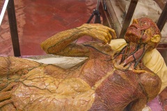 In La Specola: anatomical wax of superficial lymphatic system, by Clemente Susini, 1775-91 